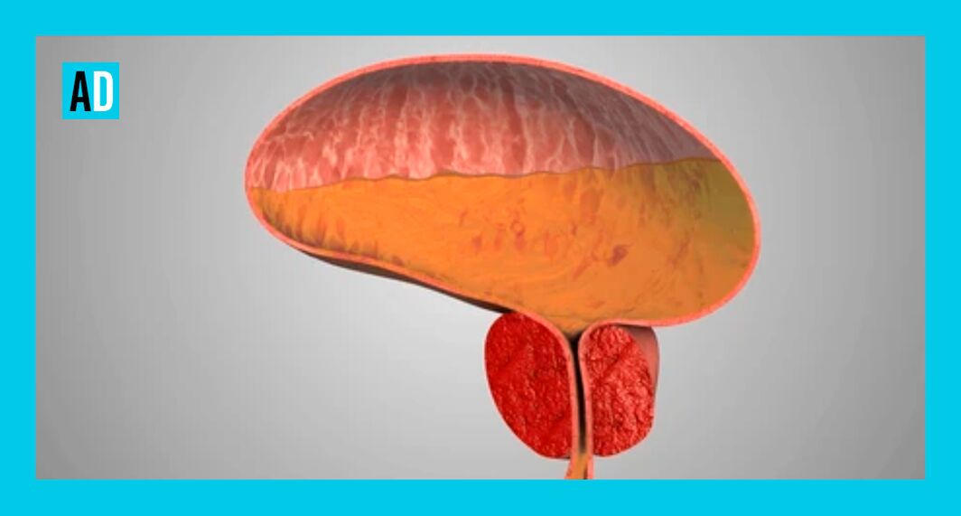 Entzündete Prostata